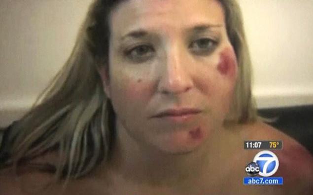 Fotos: Policías golpean brutalmente a una mujer Fotos: Policías golpean brutalmente a una mujer
