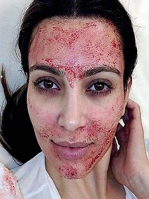 Extremo tratamiento de belleza de Kim Kardashian