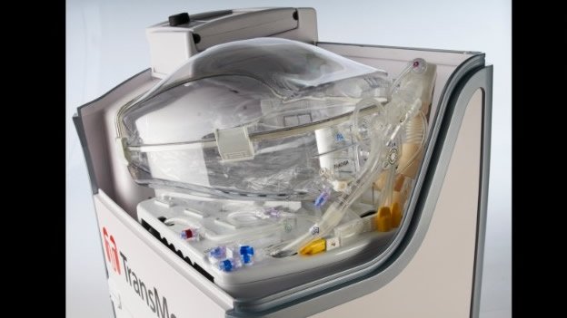 Crean una caja que mantiene 'vivos' a los órganos fuera del cuerpo