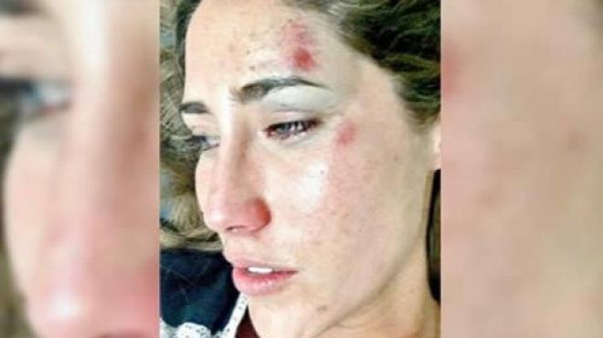 La novia de Jorge Kahwagi niega agresión del político La novia de Jorge Kahwagi niega agresión del político