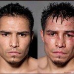 Fotos: así quedan los boxeadores luego de luchar Fotos: así quedan los boxeadores luego de luchar