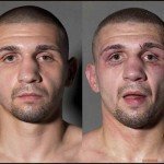 Fotos: así quedan los boxeadores luego de luchar Fotos: así quedan los boxeadores luego de luchar