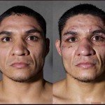 Fotos: así quedan los boxeadores luego de luchar Fotos: así quedan los boxeadores luego de luchar