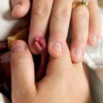 Fotos impactantes: nació con 19 semanas y logró sobrevivir unos minutos Fotos impactantes: nació con 19 semanas y logró sobrevivir unos minutos
