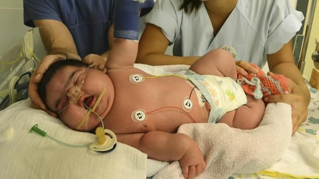 Una bebé de más de seis kilos nació por parto natural