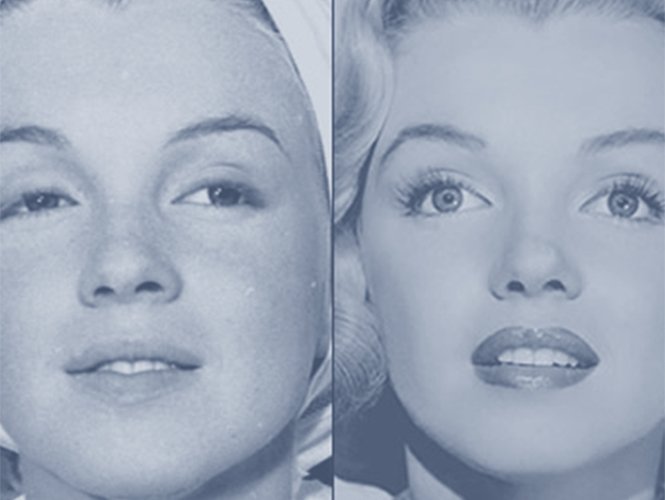 Las cirugías de Marilyn Monroe para corregir imperfecciones